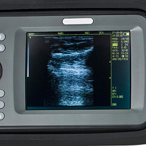 Digital Palm Smart Scanner with Rectal Probe for Veterinary US Shipment 2-5 Days Delivery