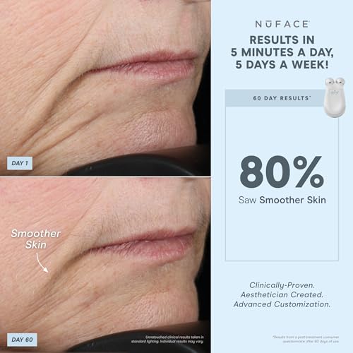 NuFACE Trinity Starter Kit – Facial Toning Device, Microcurrent to Tone, Smooth, Contour and Lift Skin in Minutes